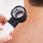 visita dermatologica nembro