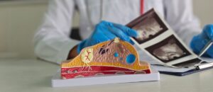 mammografia santagostino nembro