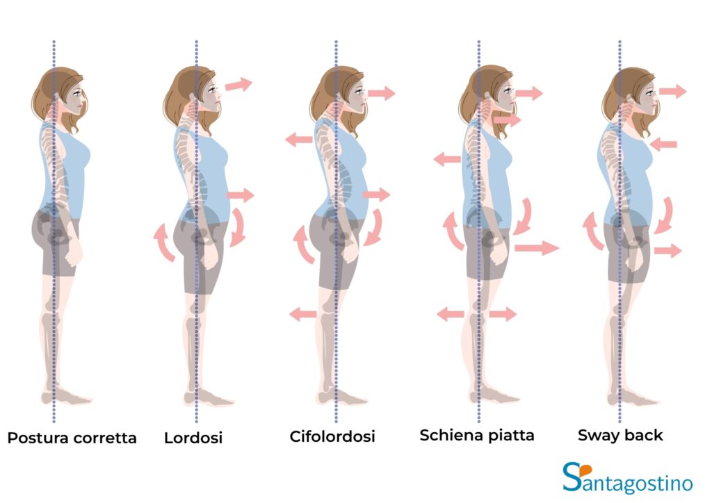 postura corretta santagostino nembro