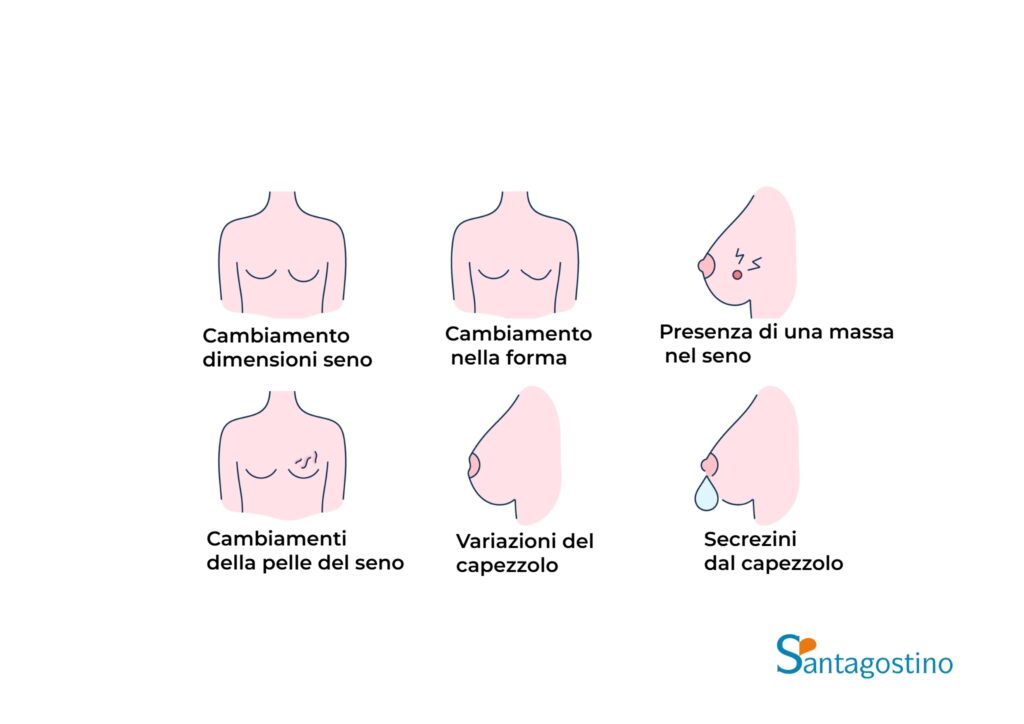 sintomi tumore al seno santagostino nembro
