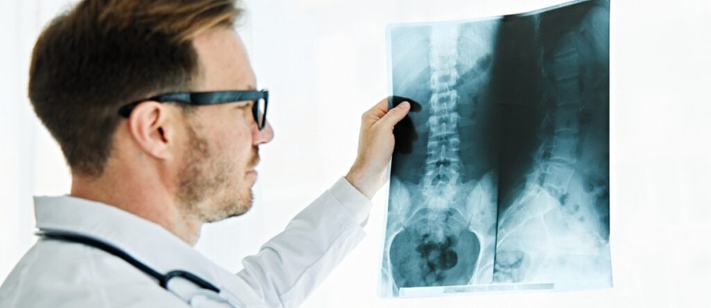 radiografia schiena santagostino nembro