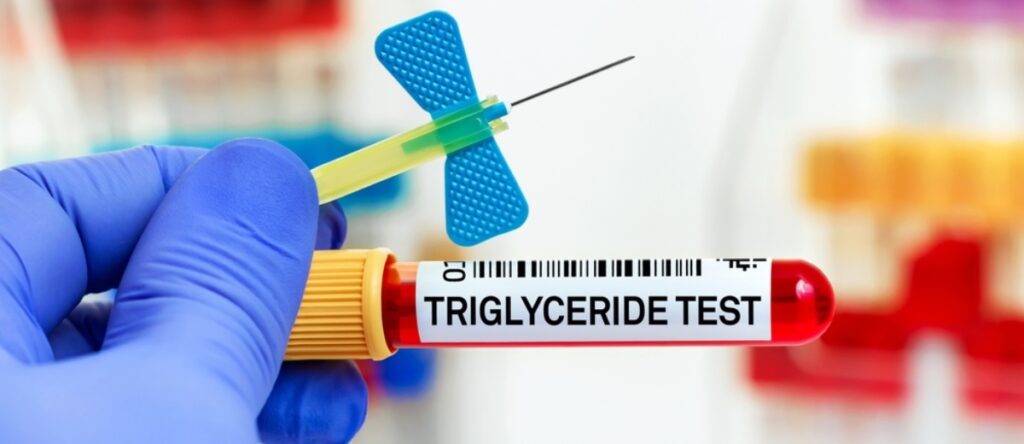 trigliceridi santagostino nembro