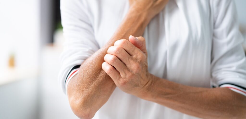 dermatite seborroica