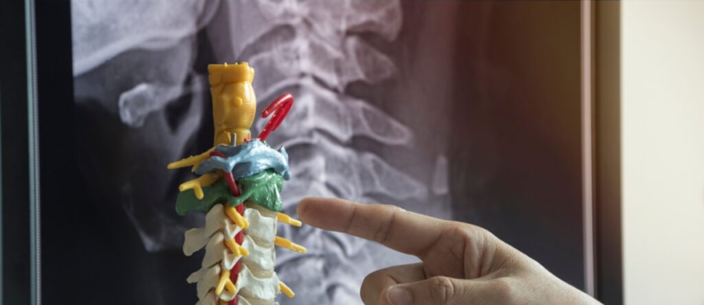 esami per cervicale santagosino nembro