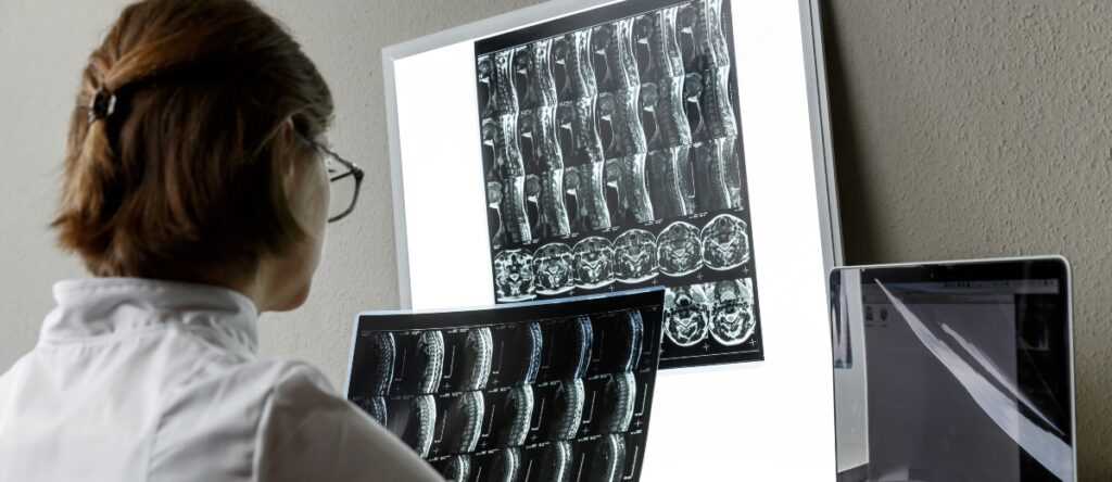 risonanza magnetica cervicale santagostino nembro