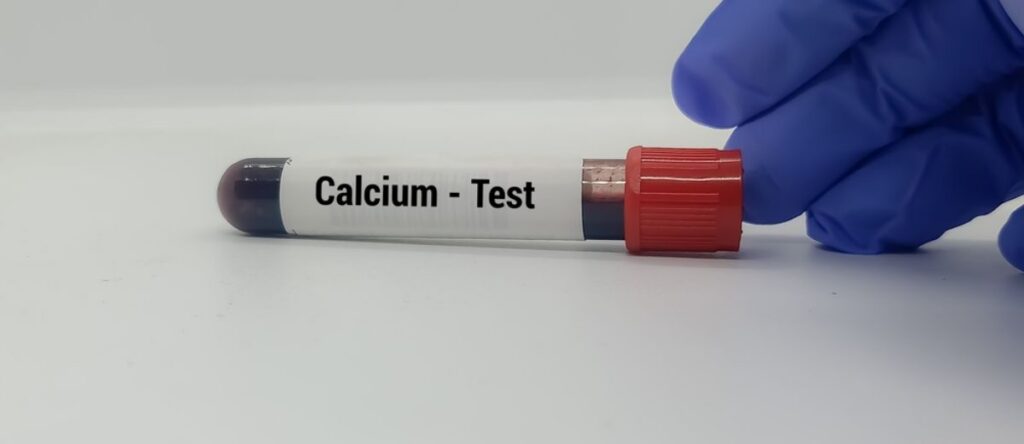 calcemia nembro